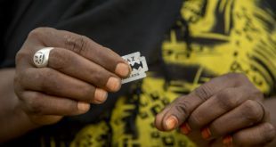 FGM